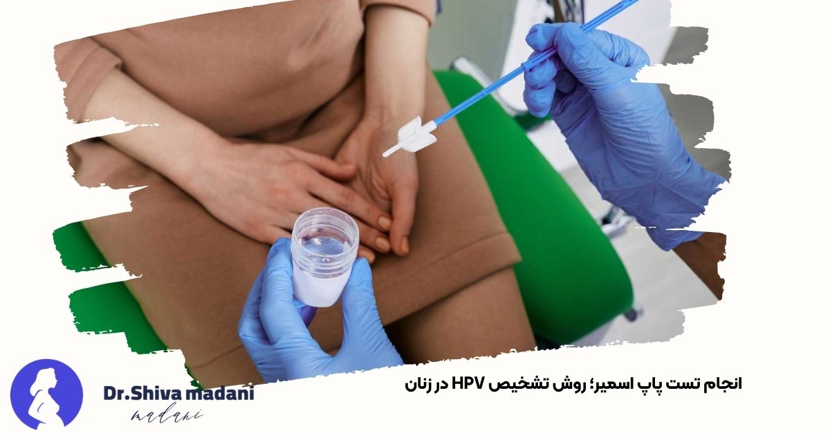 تصویری از فرآیند انجام تست پاپ اسمیر توسط پزشک برای تشخیص ویروس HPV در زنان - دکتر شیوا مدنی