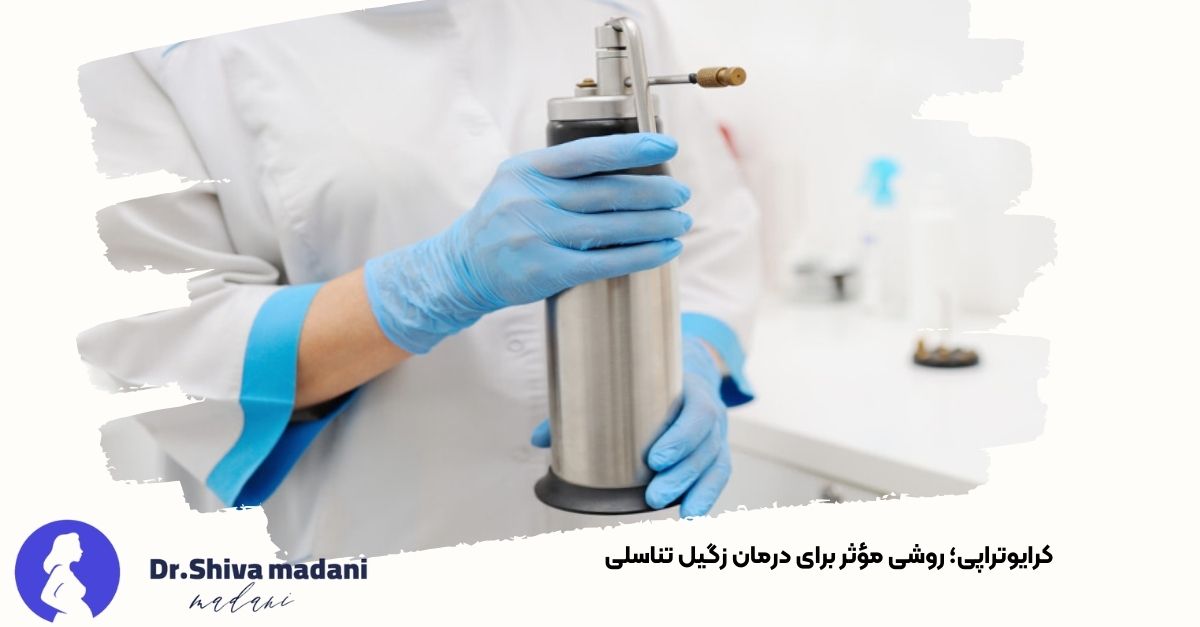 تصویری از پزشک در حال آماده‌سازی دستگاه کرایوتراپی برای درمان زگیل تناسلی - دکتر شیوا مدنی