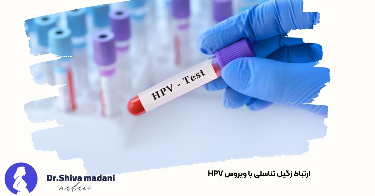 تصویری از زگیل تناسلی به عنوان یکی از علائم ویروس HPV - دکتر شیوا مدنی