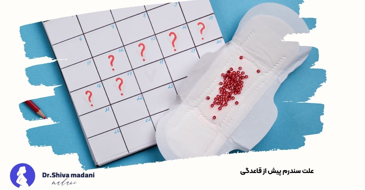 قاعدگی چیست و روش های درمان آن 