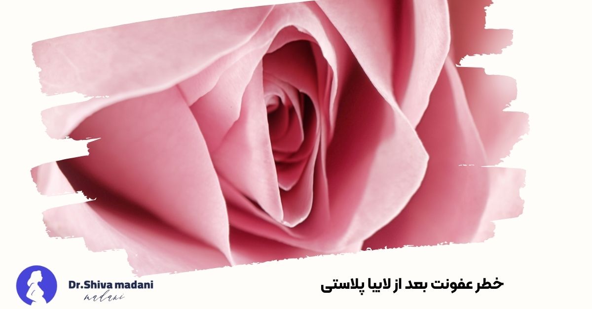 خطر عفونت بعد از لابیا پلاستی