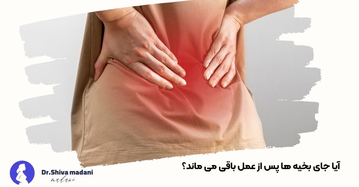 آیا جای بخیه ها پس از عمل باقی می ماند؟