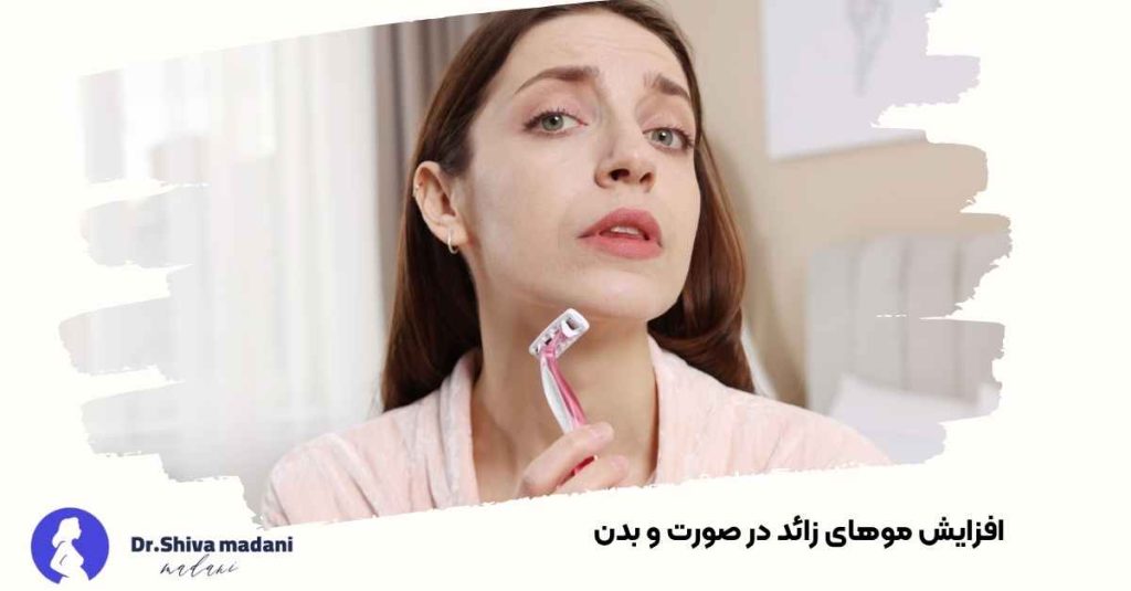 افزایش موهای زائد در صورت و بدن