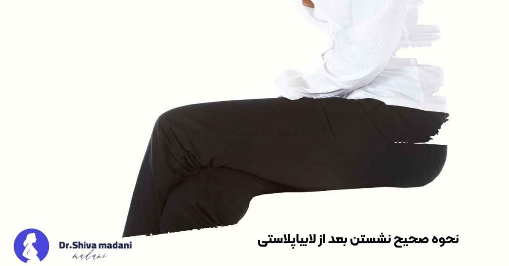 نحوه صحیح نشستن بعد از لابیاپلاستی