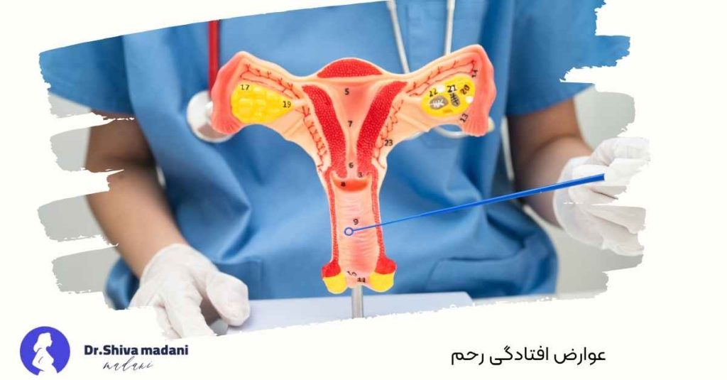 عوارض افتادگی رحم