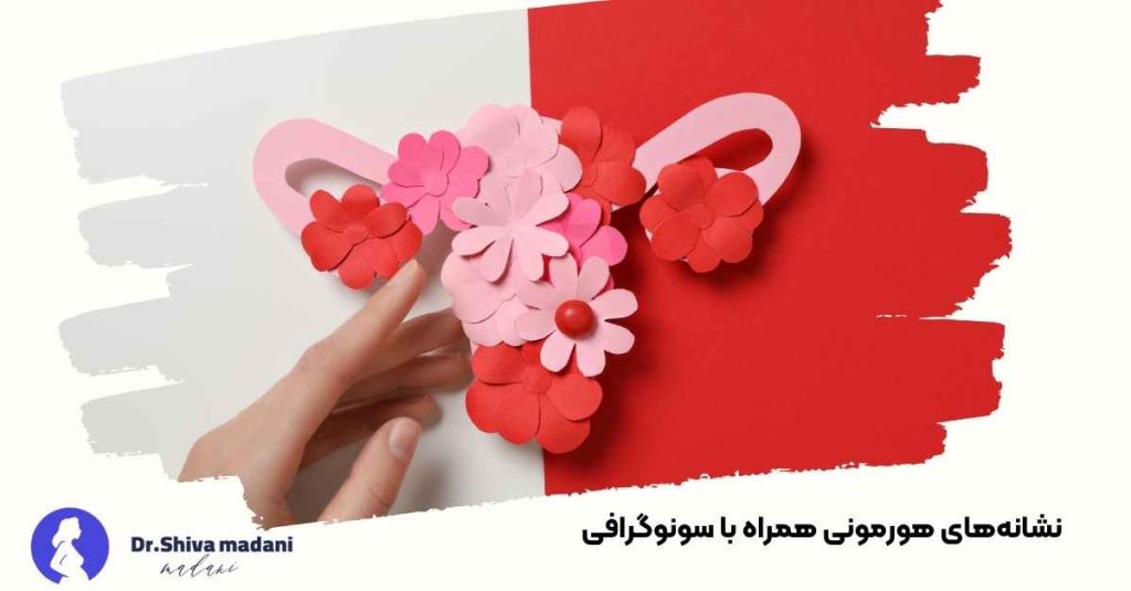 نشانه‌های هورمونی همراه با سونوگرافی