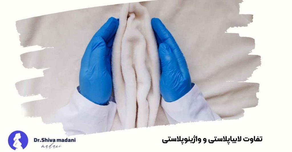 تفاوت لابیاپلاستی و واژینوپلاستی