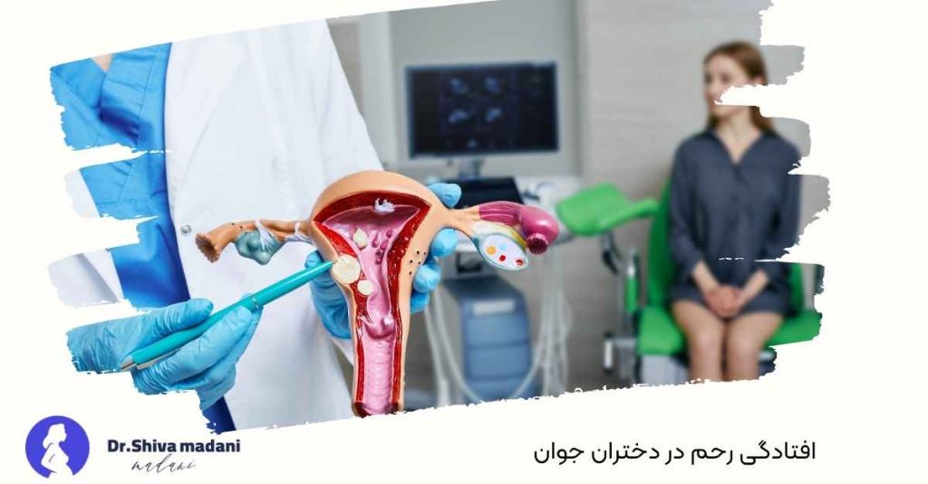 افتادگی رحم در دختران جوان