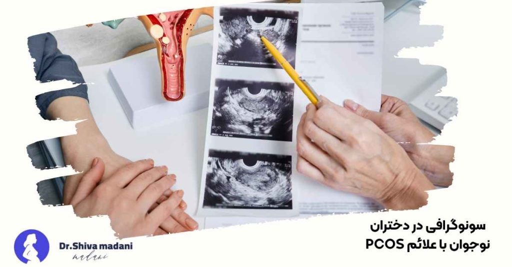 سونوگرافی در دختران نوجوان با علائم PCOS