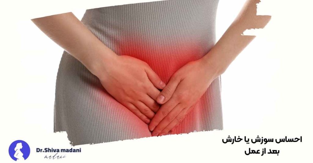 احساس سوزش یا خارش بعد از عمل
