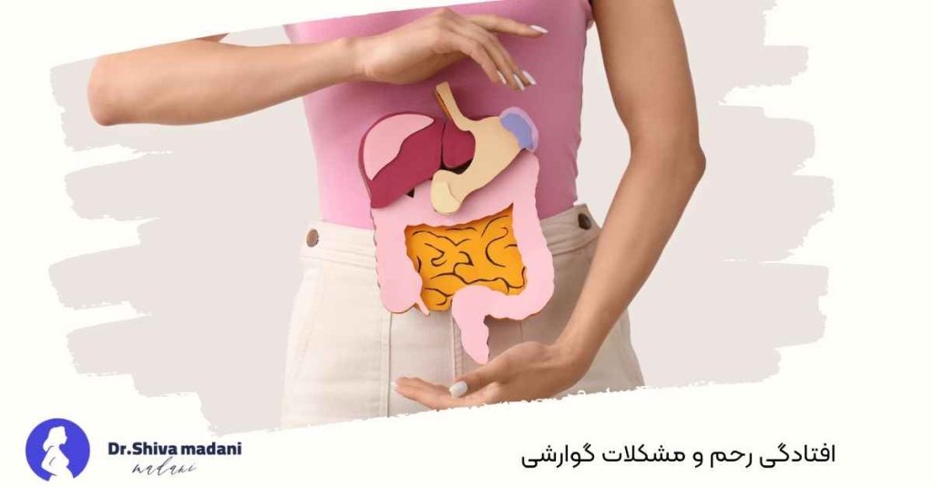 افتادگی رحم و مشکلات گوارشی
