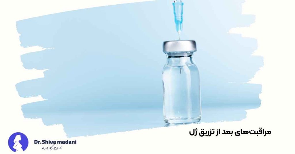 مراقبتهای قبل از تزریق ژل