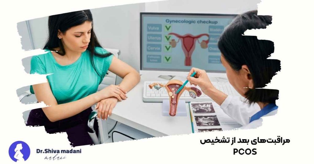 مراقبت‌های بعد از تشخیص PCOS