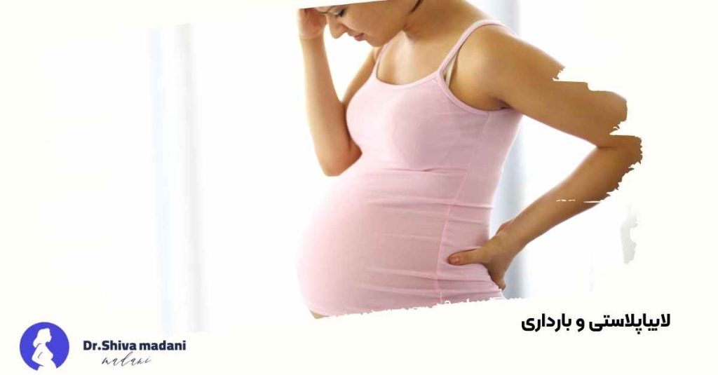 لابیاپلاستی و بارداری