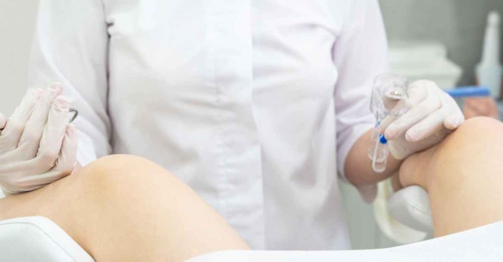 ماندگاری لیفت واژن با نخ