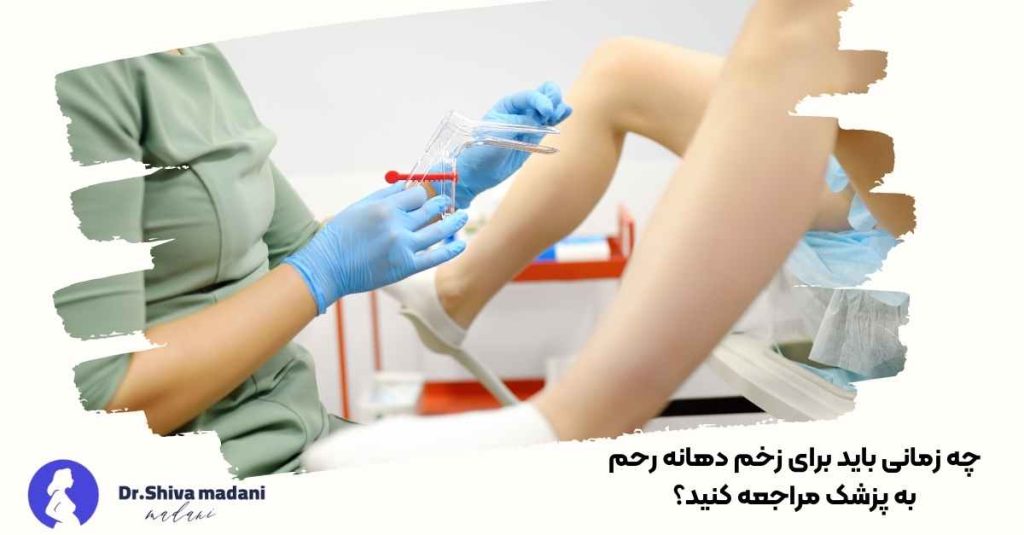 کی برای زخم دهانه رحم به پزشک مراجعه کنید؟