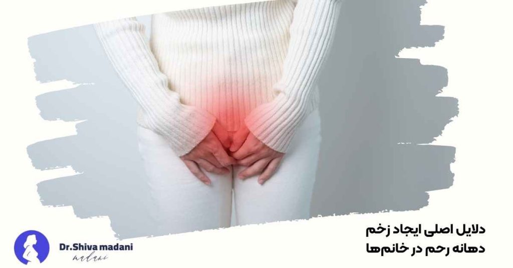 دلایل اصلی ایجاد زخم دهانه رحم در خانم‌ها