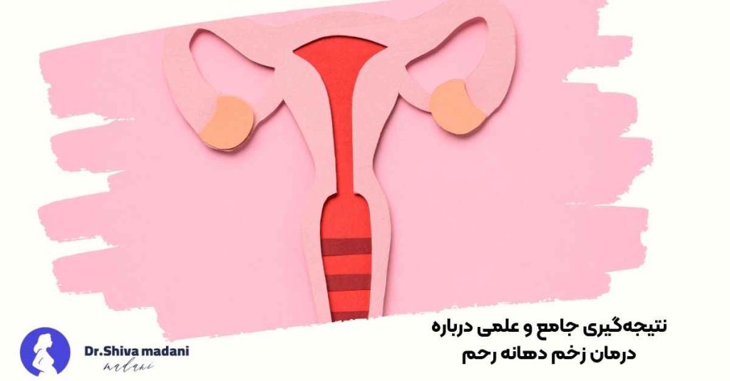 همه چیز درباره درمان زخم دهانه رحم