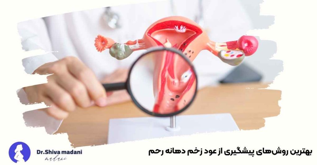 بهترین روش‌های پیشگیری از عود زخم دهانه رحم