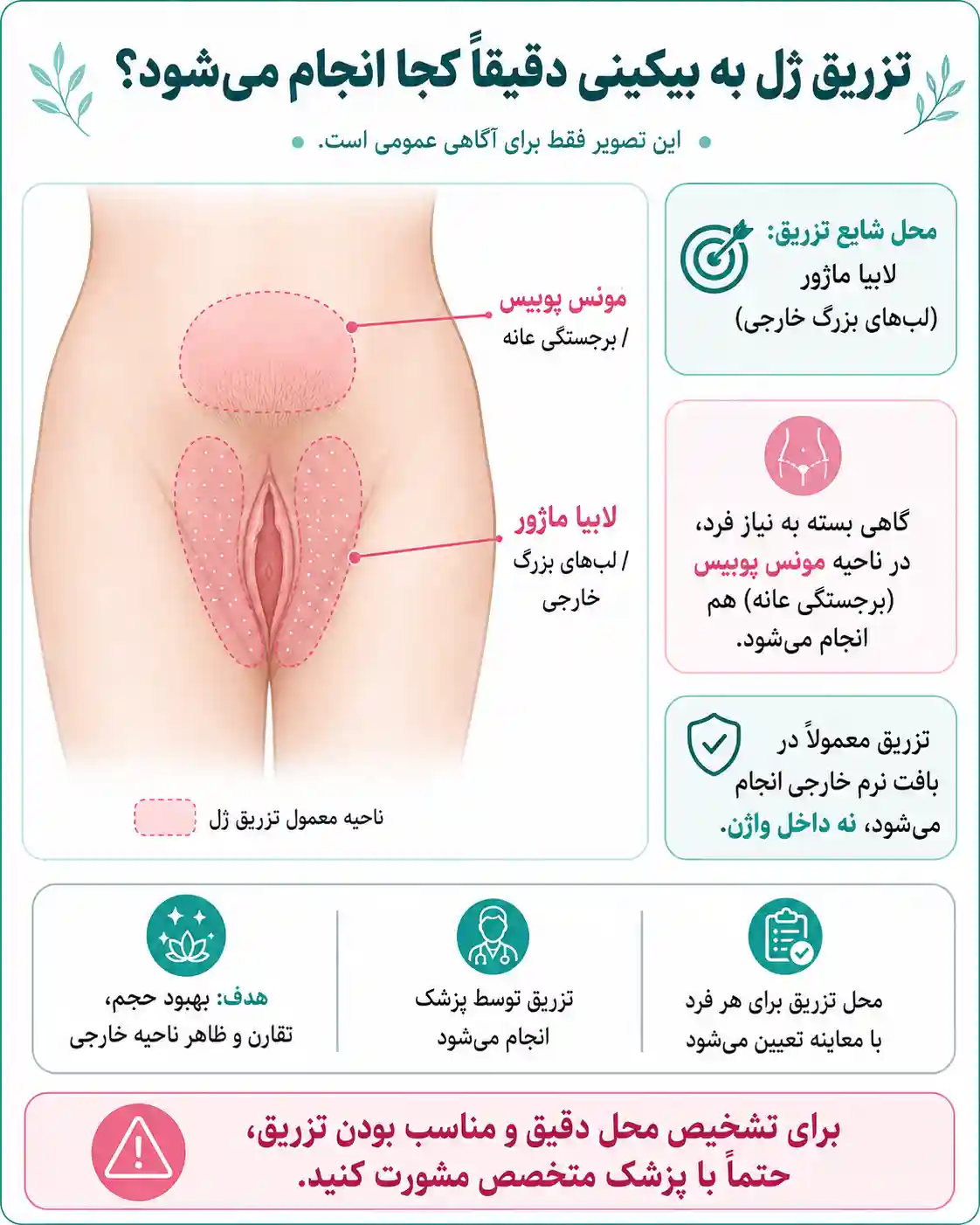 تزریق ژل به بیکینی دقیقاً در کدام قسمت انجام میشود؟