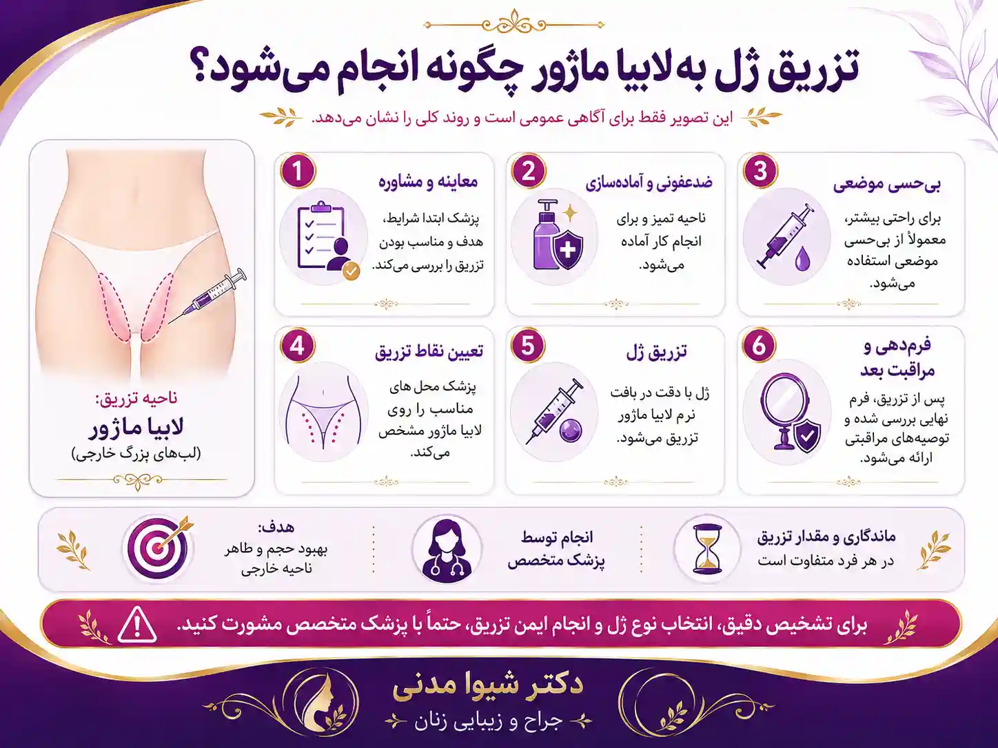 تزریق ژل به لابیا ماژور چگونه انجام میشود؟