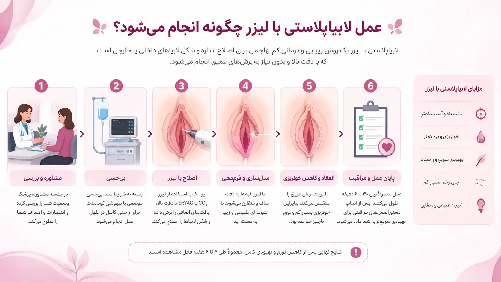 عمل لابیاپلاستی با لیزر چگونه انجام می‌شود؟
